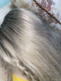 Система замещения волос