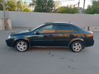 Chevrolet Lacetti 1.4 МТ, 2011, 194 175 км